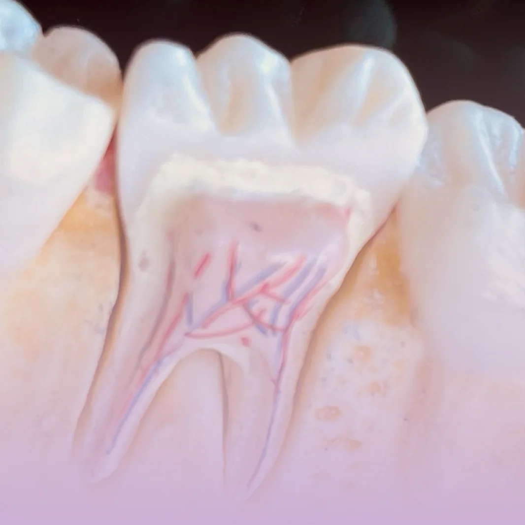 Tratamento de canal na Contreras Odontologia, em Santa Felicidade, Curitiba